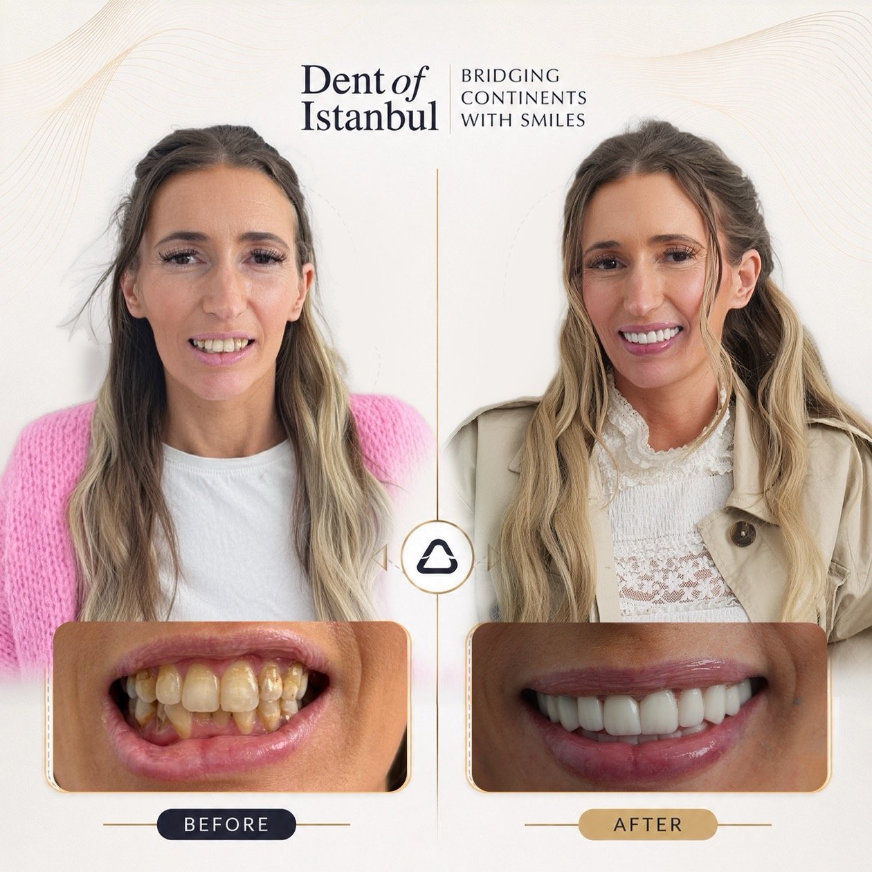 Hannah Before and After